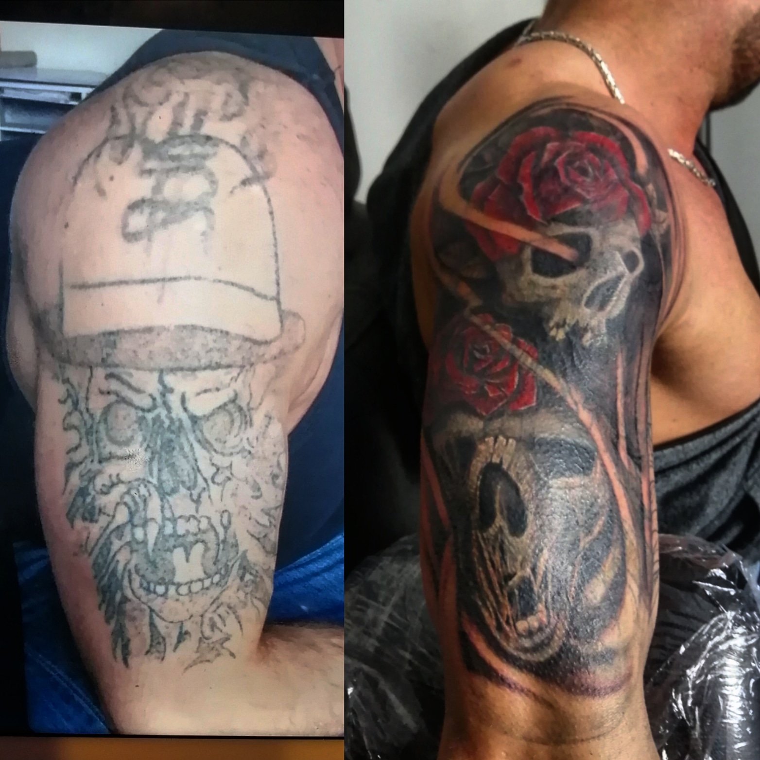 Schwierigster Cover-Up Neuss - Vernarbt Kensenich